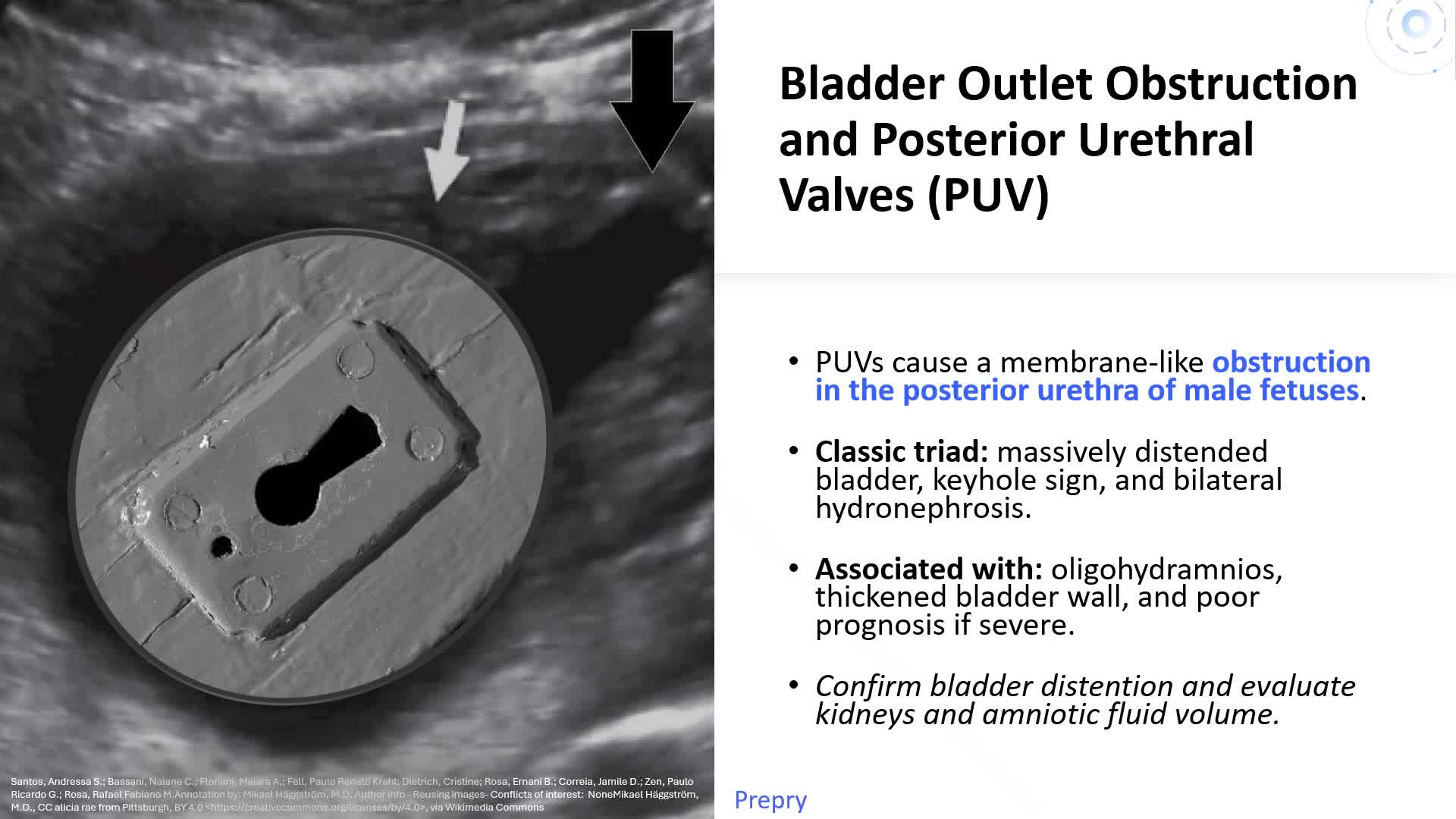 Unit 19 Genitourinary Abnormalities