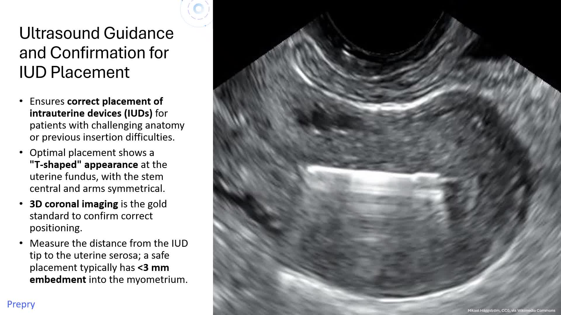 Unit 7 OBGYN Procedures pt 2