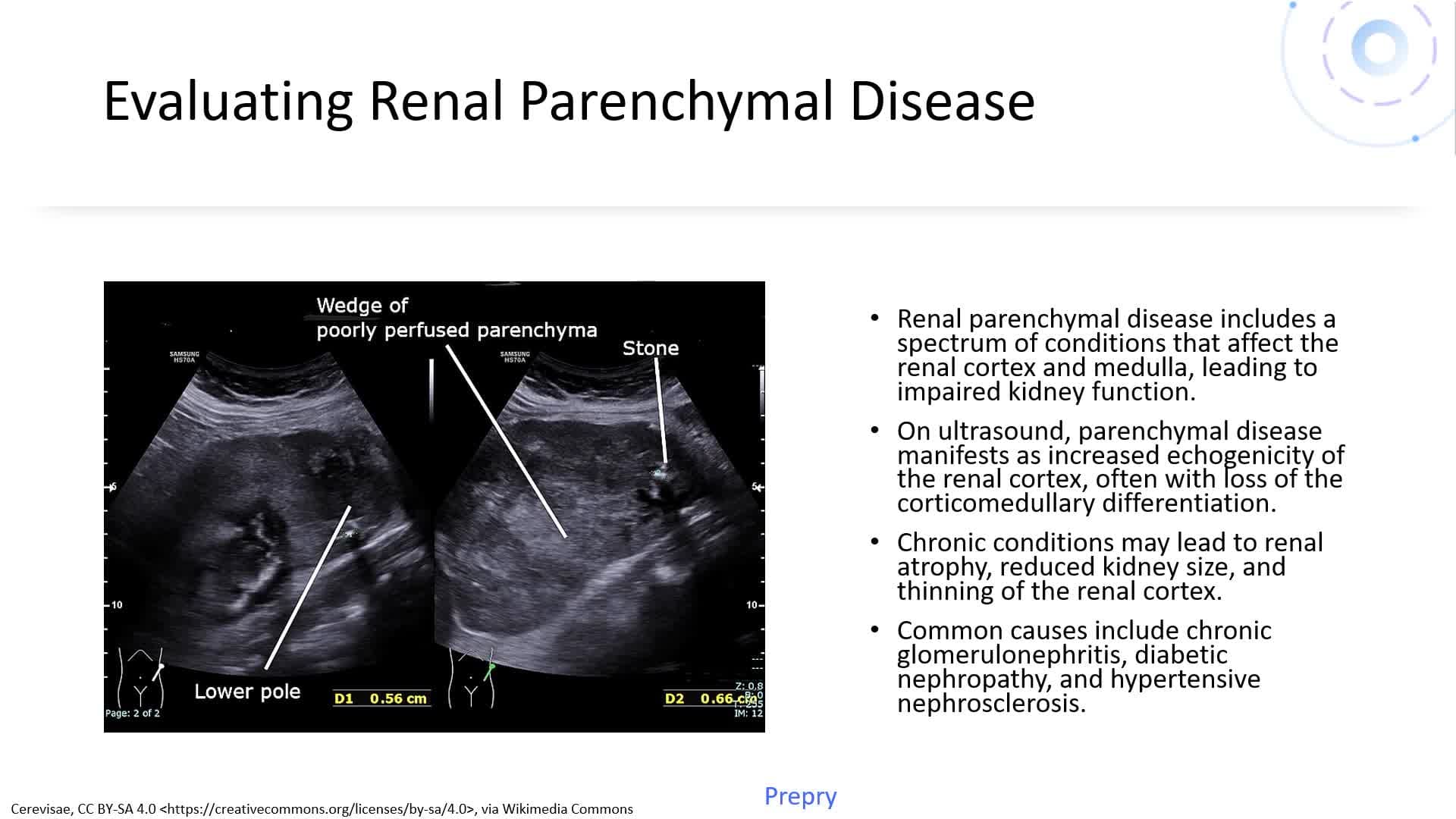 Urinary System Pathology