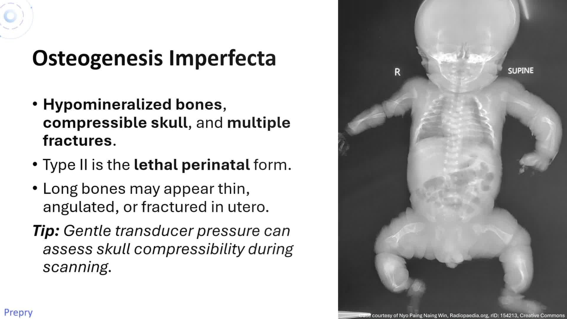 Unit 20 Skeletal Abnormalities