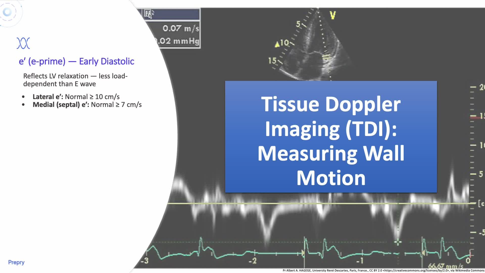 2.4 Physiology & Inflow