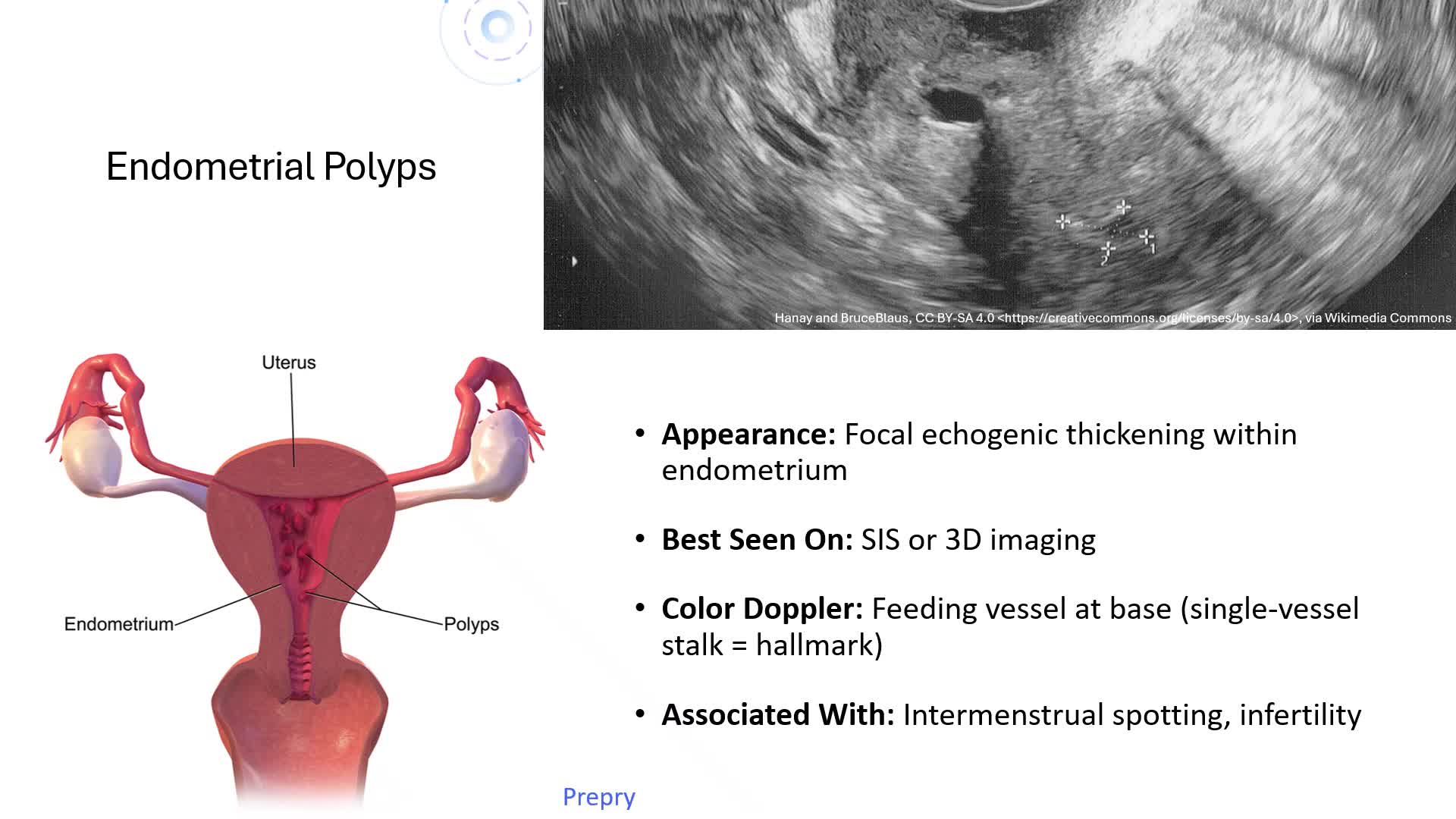 Unit 3 Pt. 2 Uterine Pathology