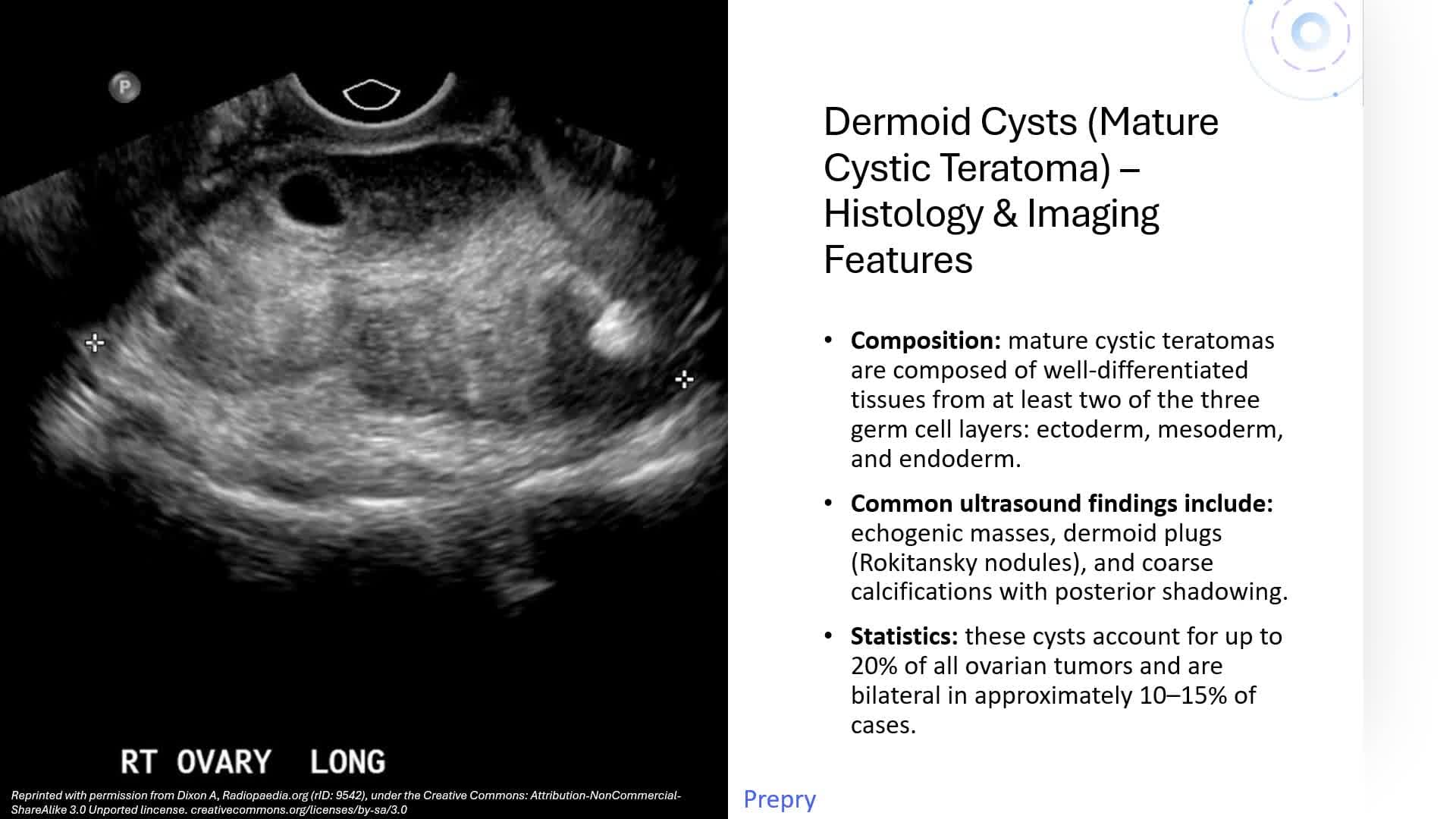 Unit 5 Ovarian Pathology Pt 1