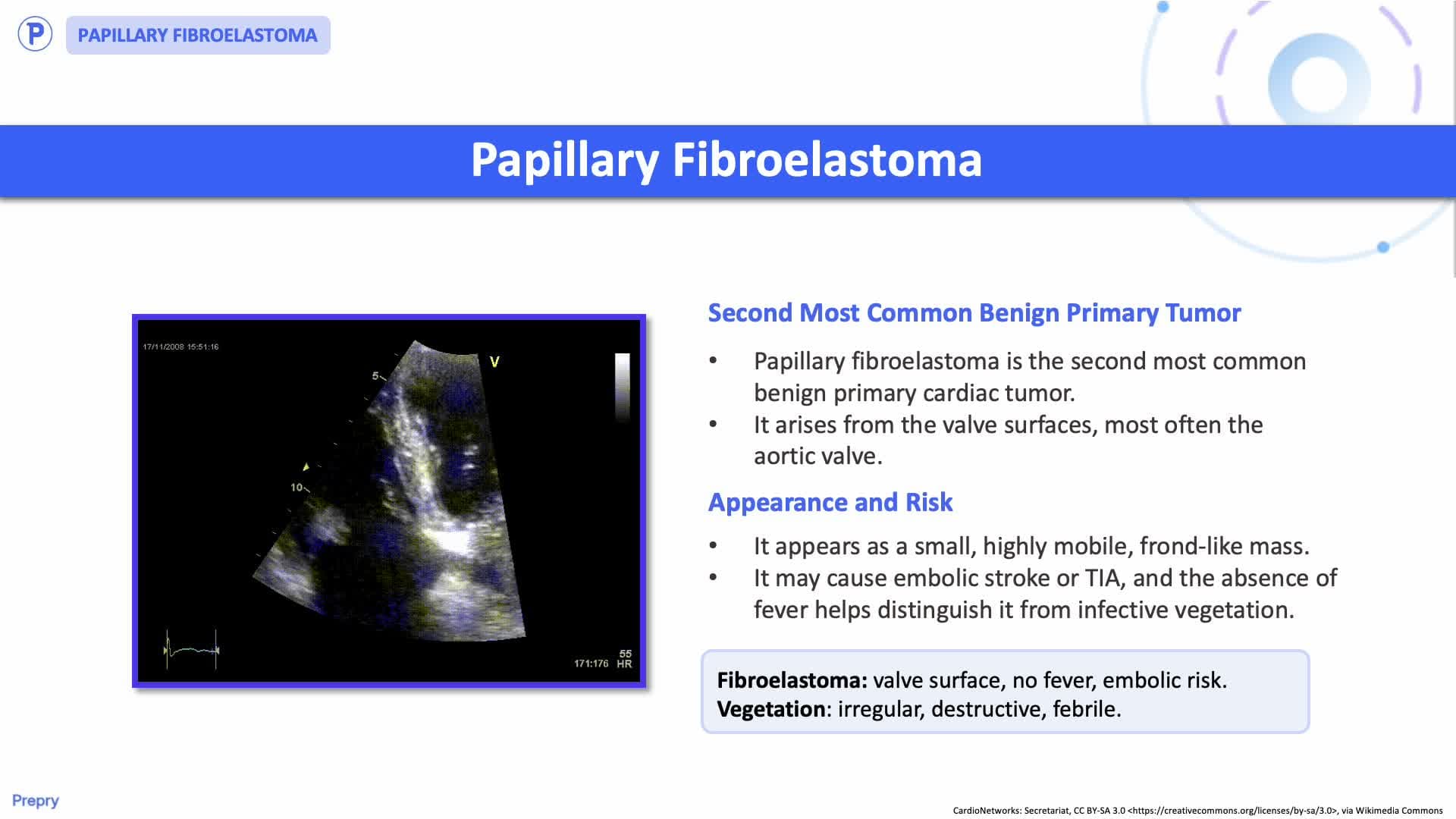 4.4 Cardiac Masses