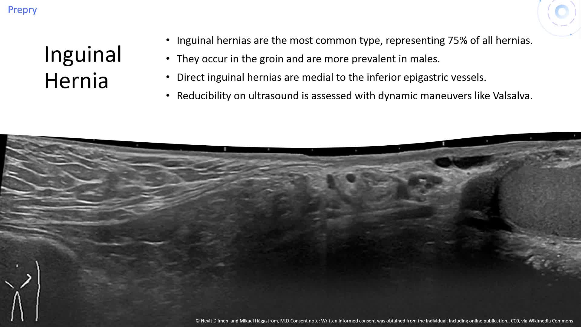 Pathology of Superficial Structures