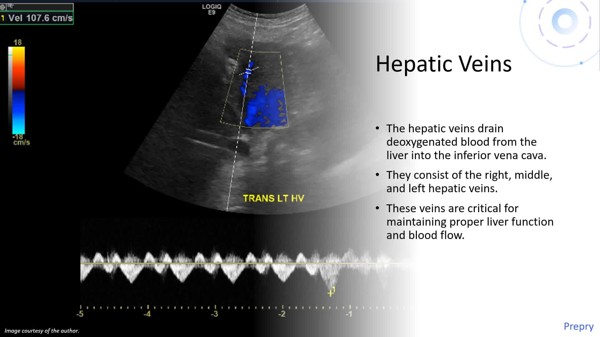Anatomy of the Liver and Spleen - Part 1: Liver Anatomy