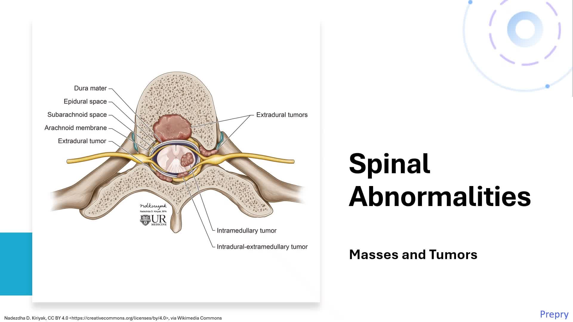 Unit 15 Intracranial-CNS Abnormalities Spine Pt 2