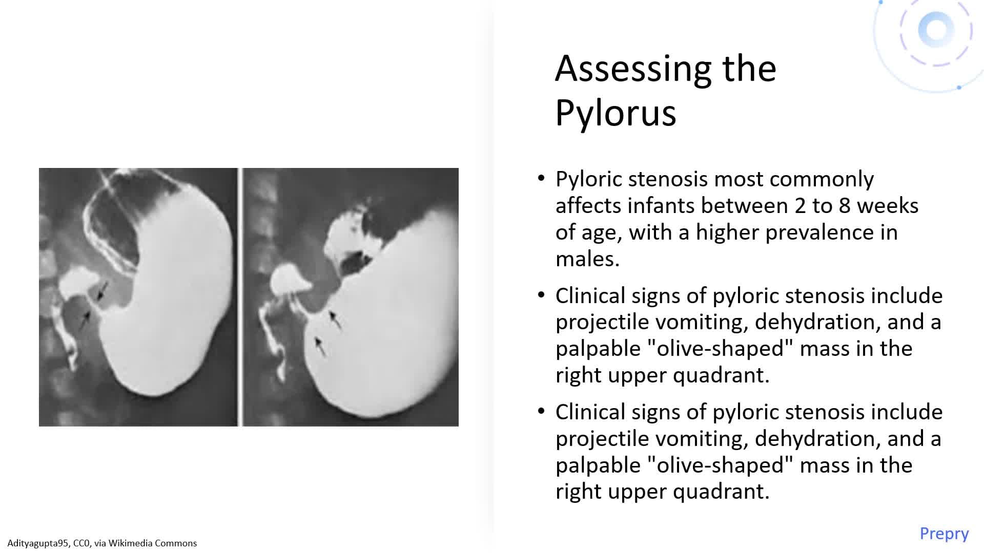 Gastrointestinal (GI) System - Part 1