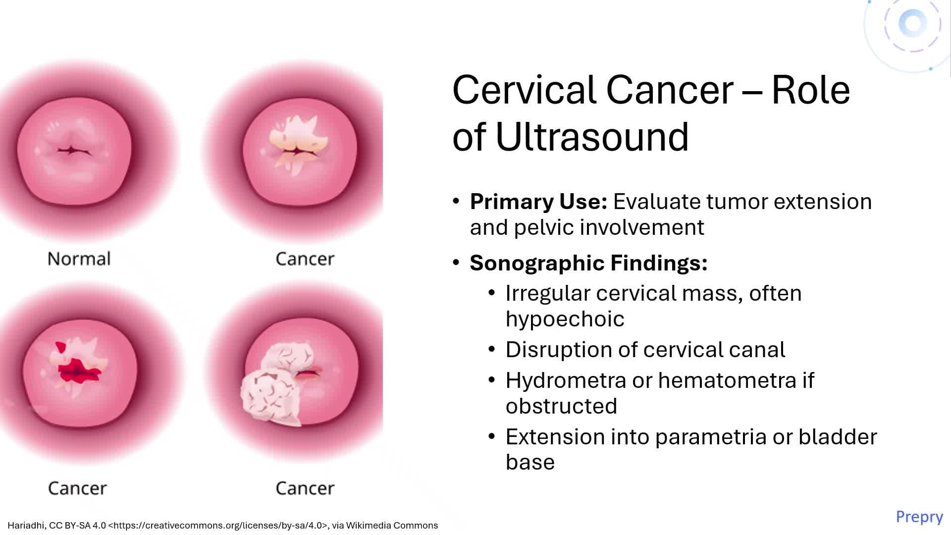 Unit 3 Pt. 3 Uterine Pathology