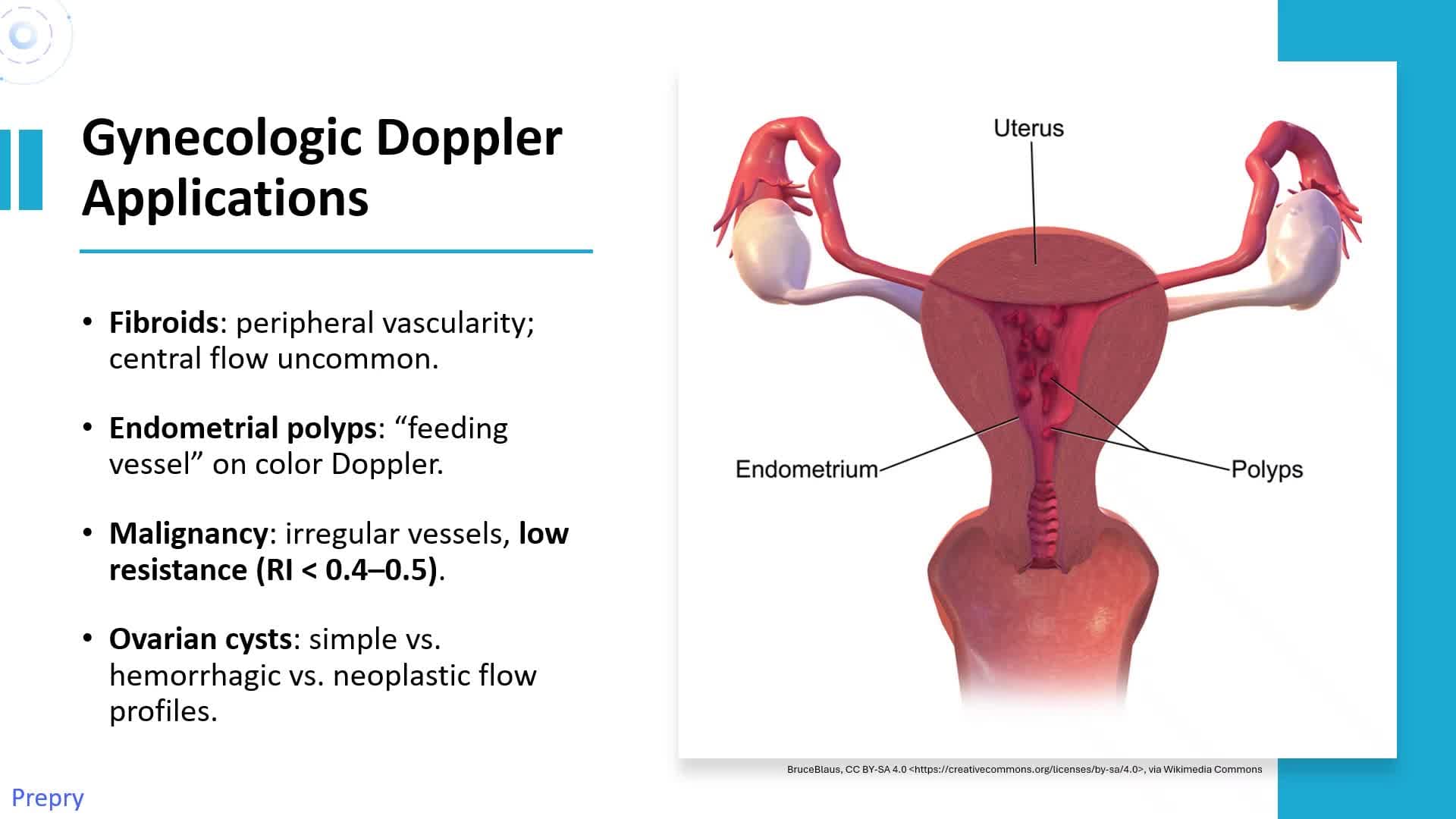 Unit 25 US Physics, Doppler, ALARA Pt. 2
