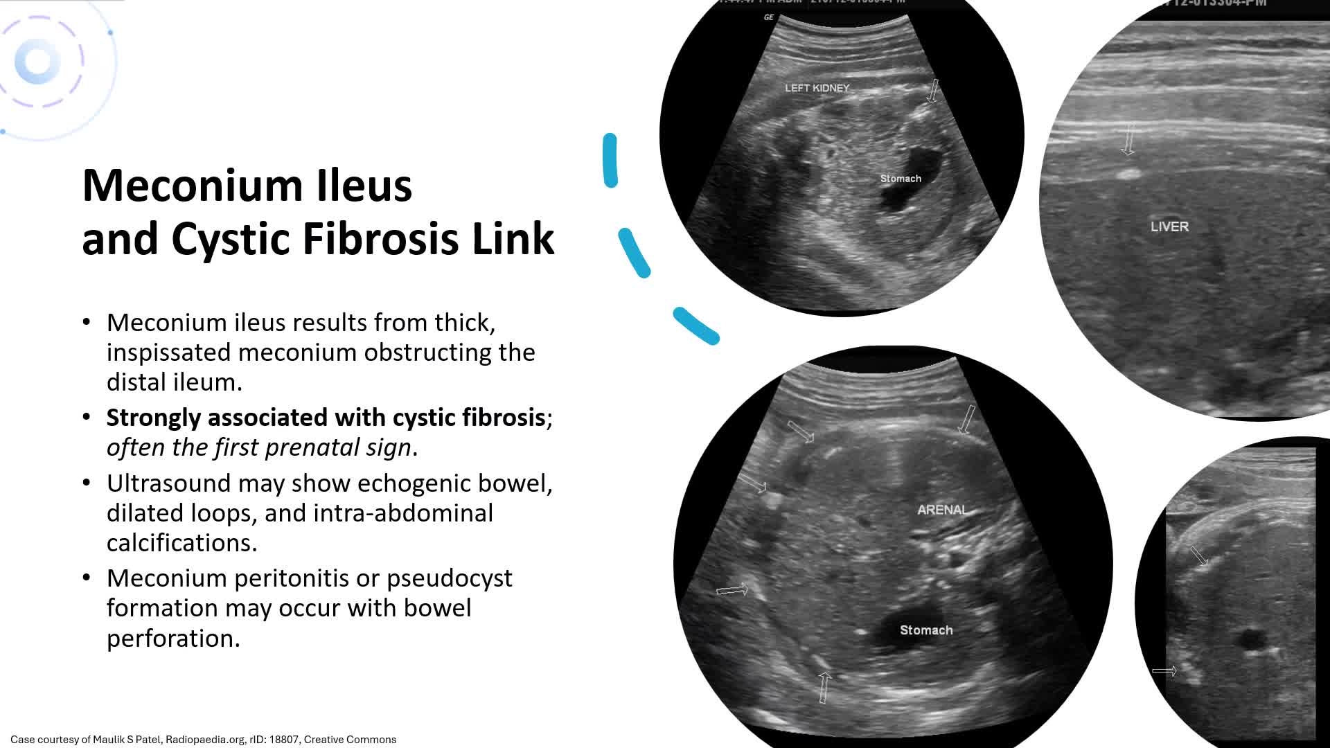 Unit 18 Abdominal Abnormalities