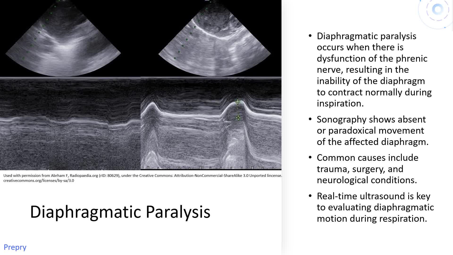 Chest and Breast Pathology - Part 2