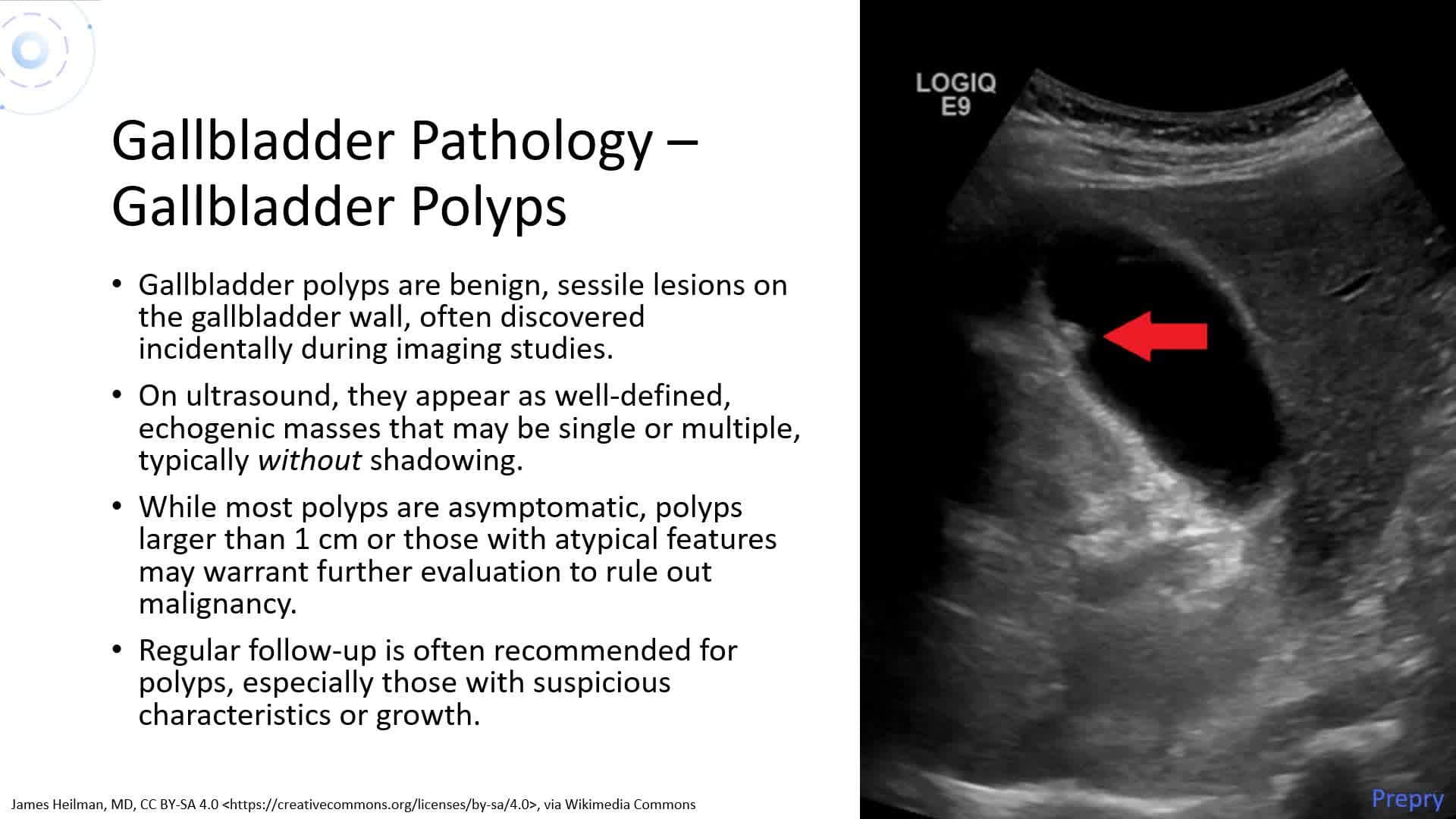 Pathology of the Biliary System and Pancreas - Part 1: Biliary Pathology