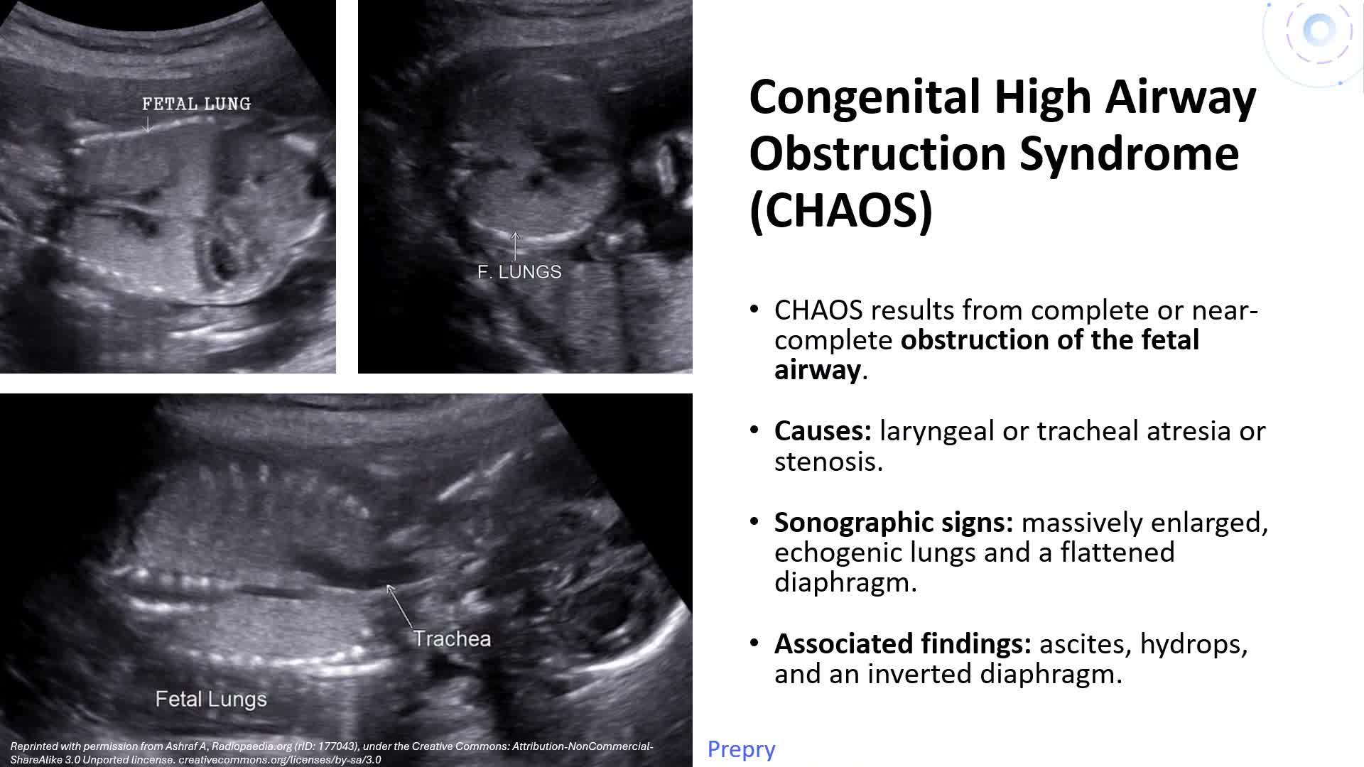 Unit 16 Thoracic Abnormalities