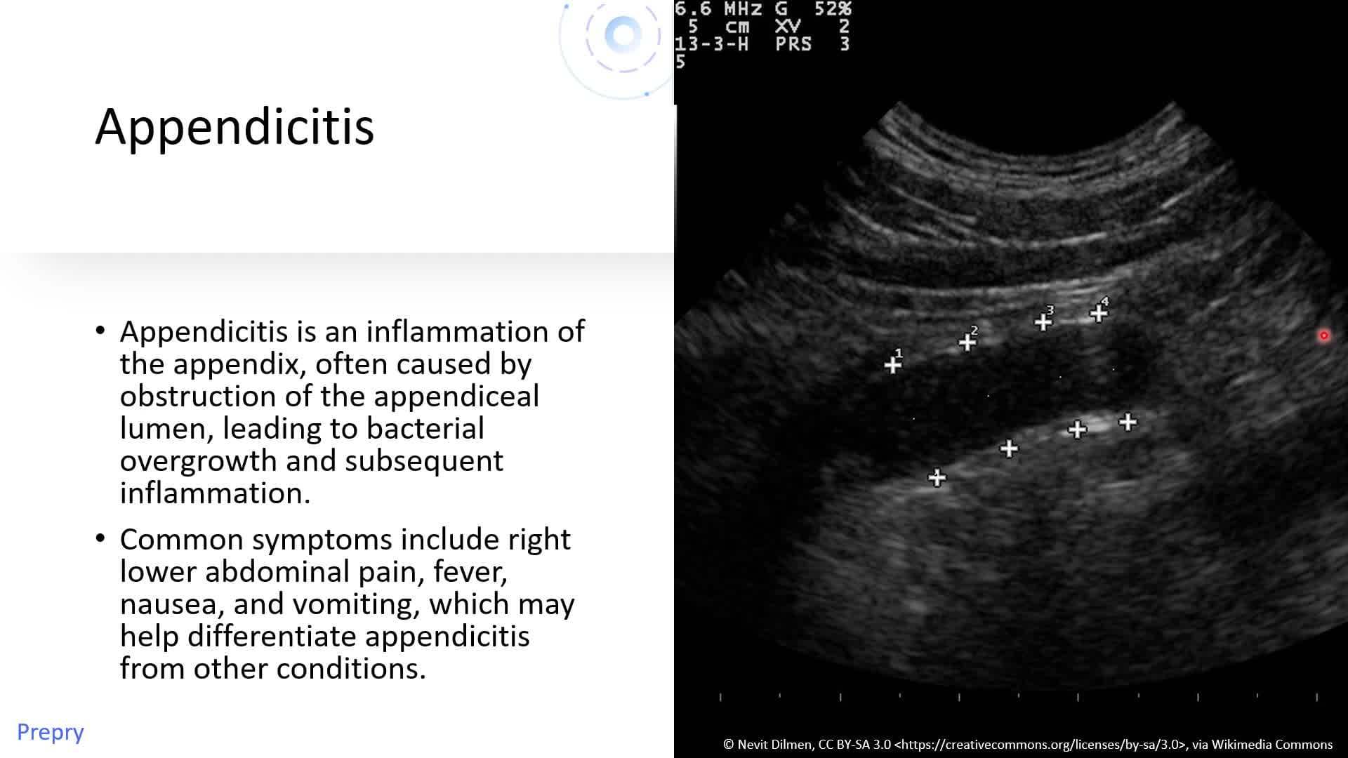 Gastrointestinal (GI) System - Part 2