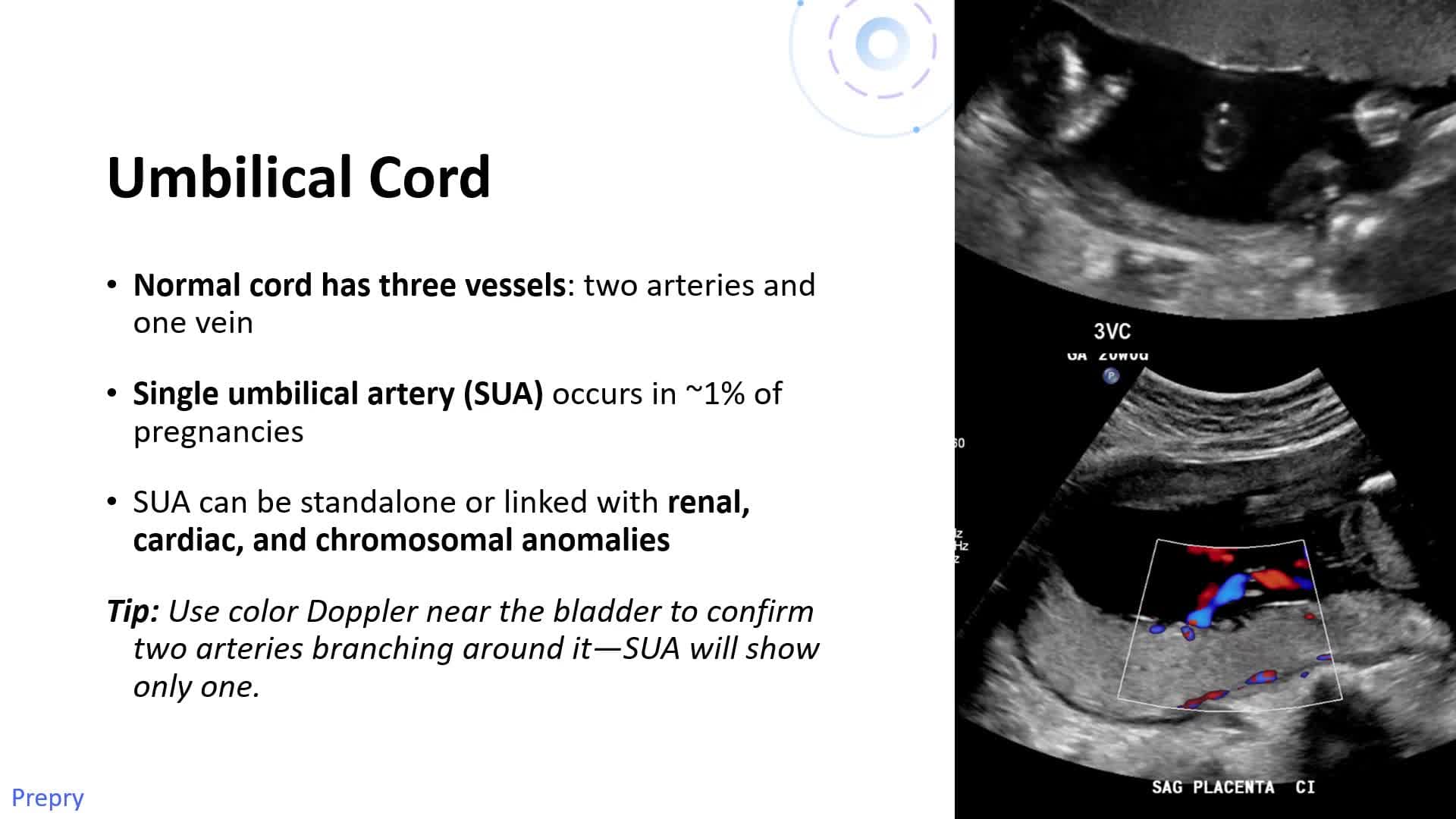 Unit 11 2-3 Trimester A&P Pt 3