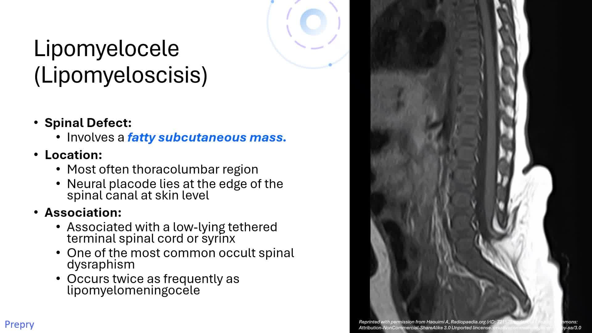 Unit 15 Intracranial-CNS Abnormalities Spine Pt 1