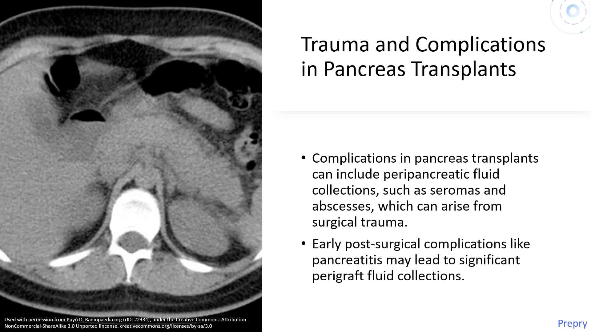 Abdominal Transplants and Postoperative Assessment - Part 2