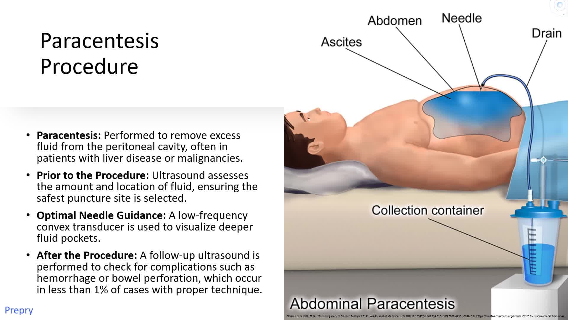 Abdominal Procedures