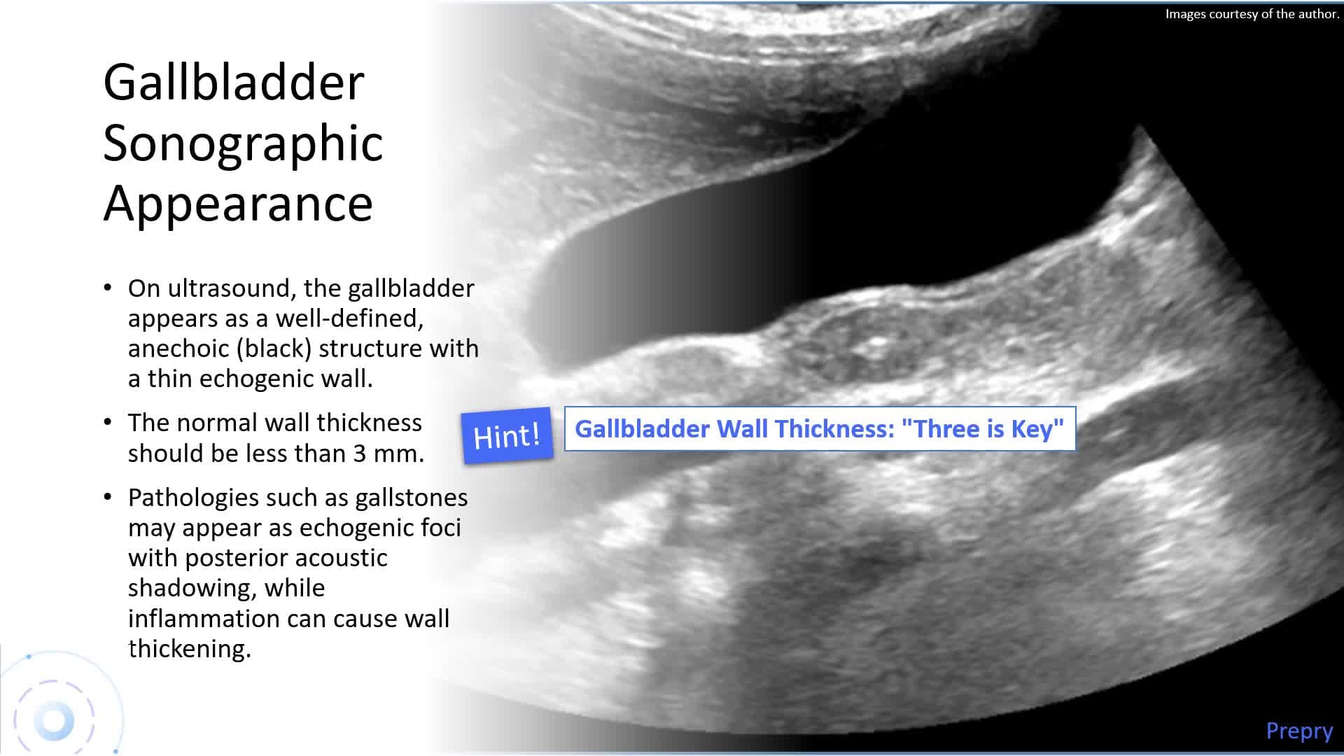 Biliary System and Pancreas - Part 1: Biliary System