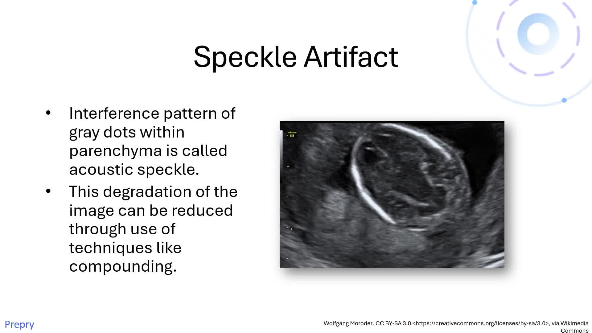 Unit 24 US Physics, Understanding Artifacts and Optimizing Image Quality Pt 2