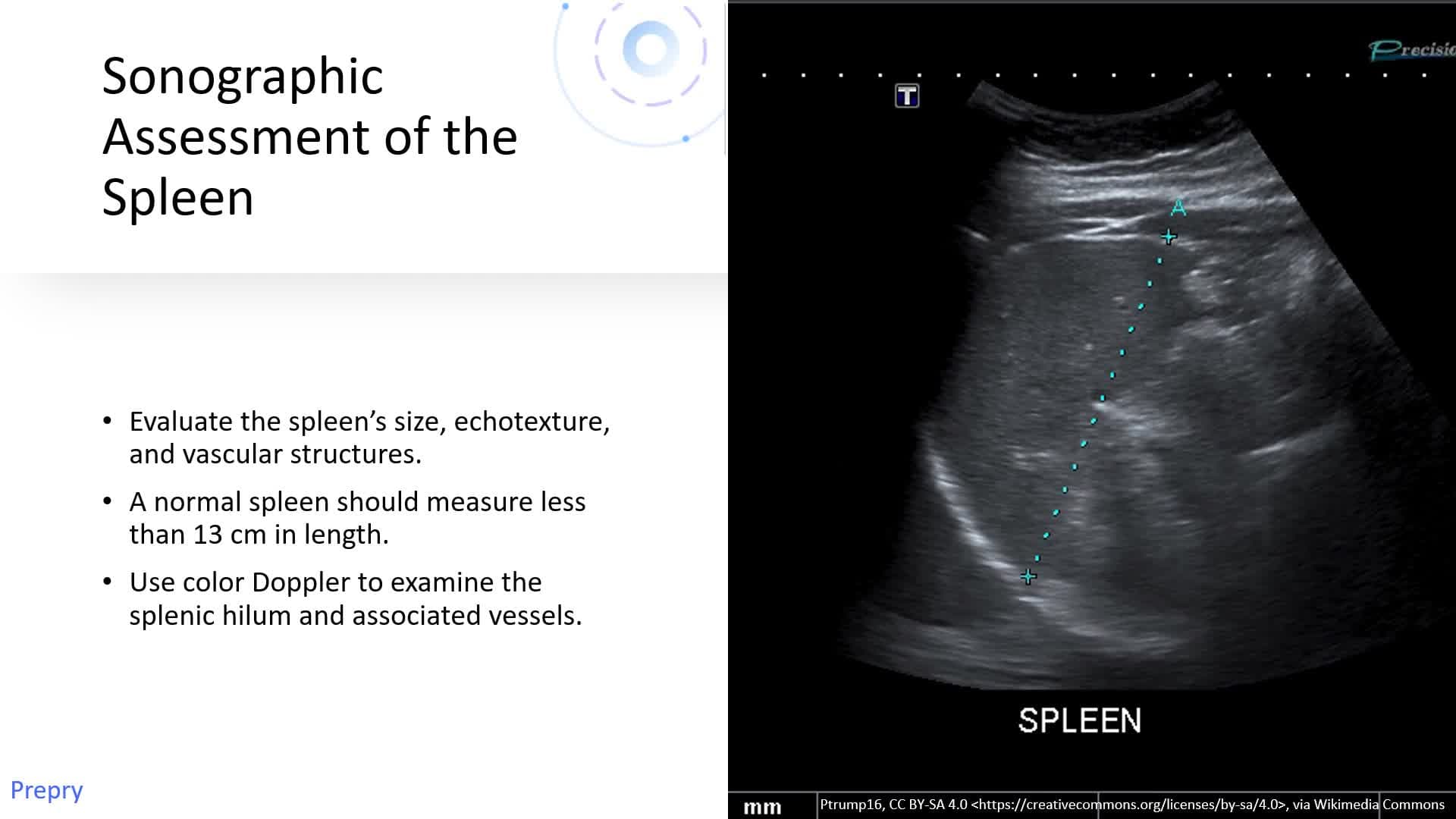 Anatomy of the Liver and Spleen - Part 2: Spleen Anatomy