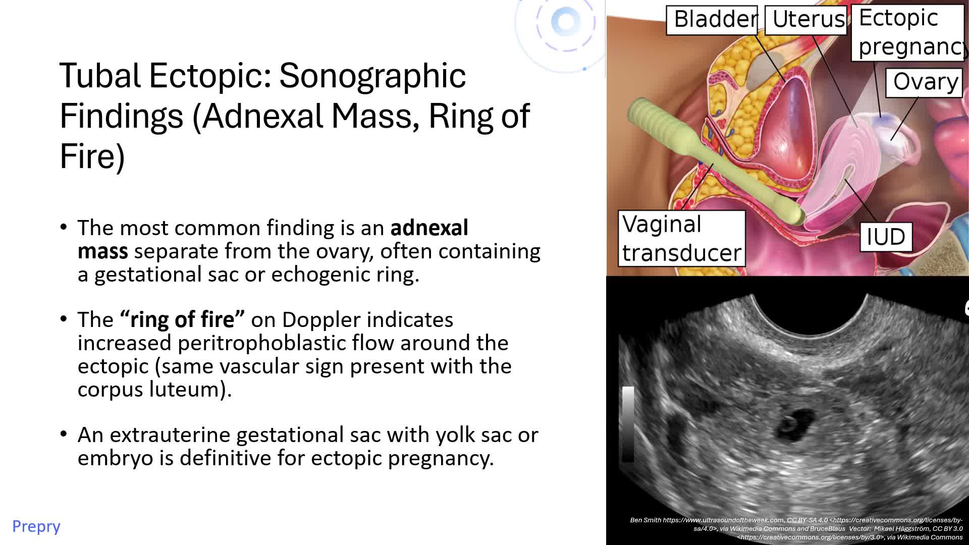 Unit 9 First Trimester Abnormalities