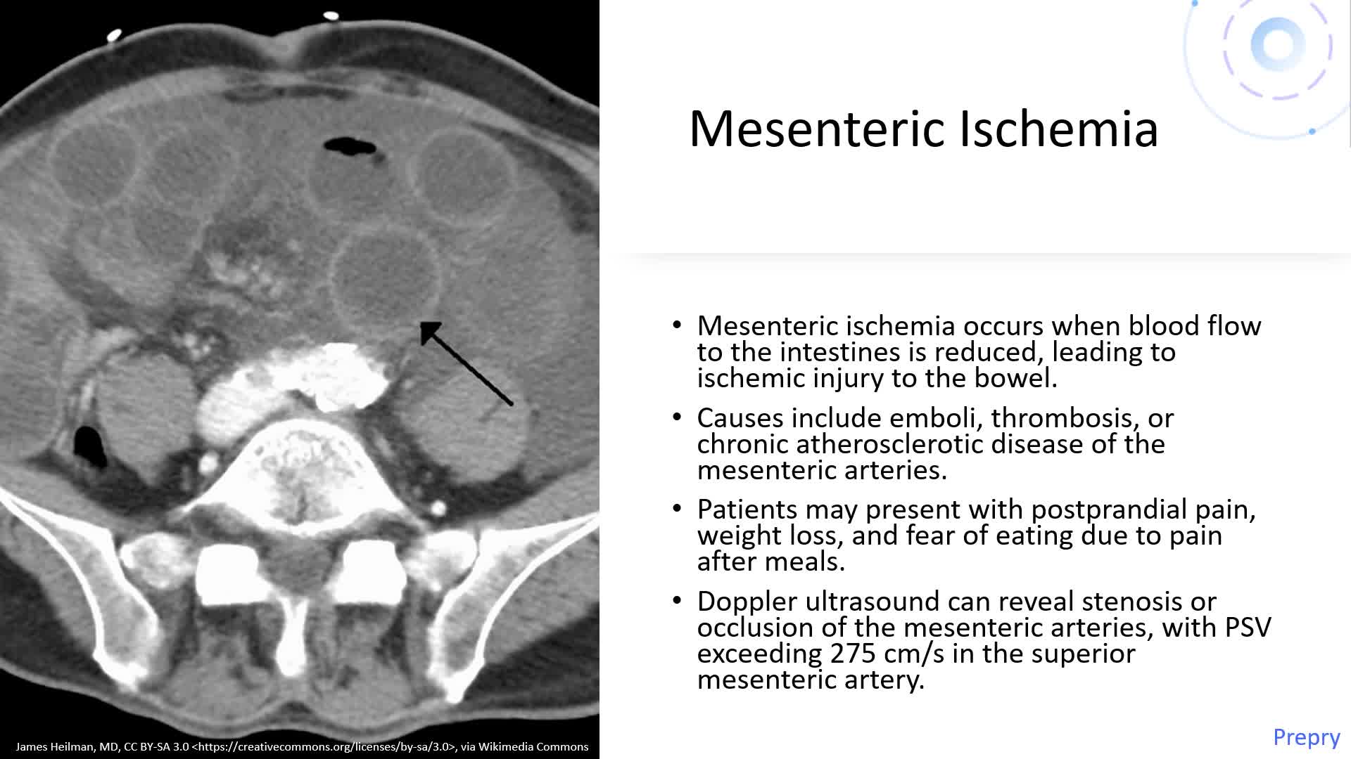 Abdominal Vascular Pathology - Part 1