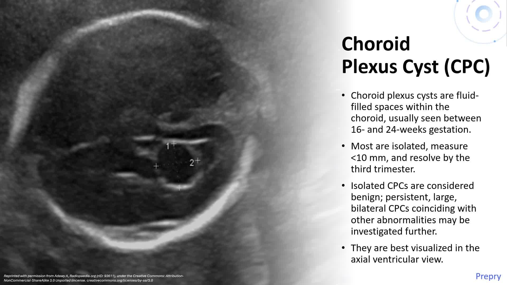 Unit 14 Intracranial-CNS Abnormalities Brain Pt 1