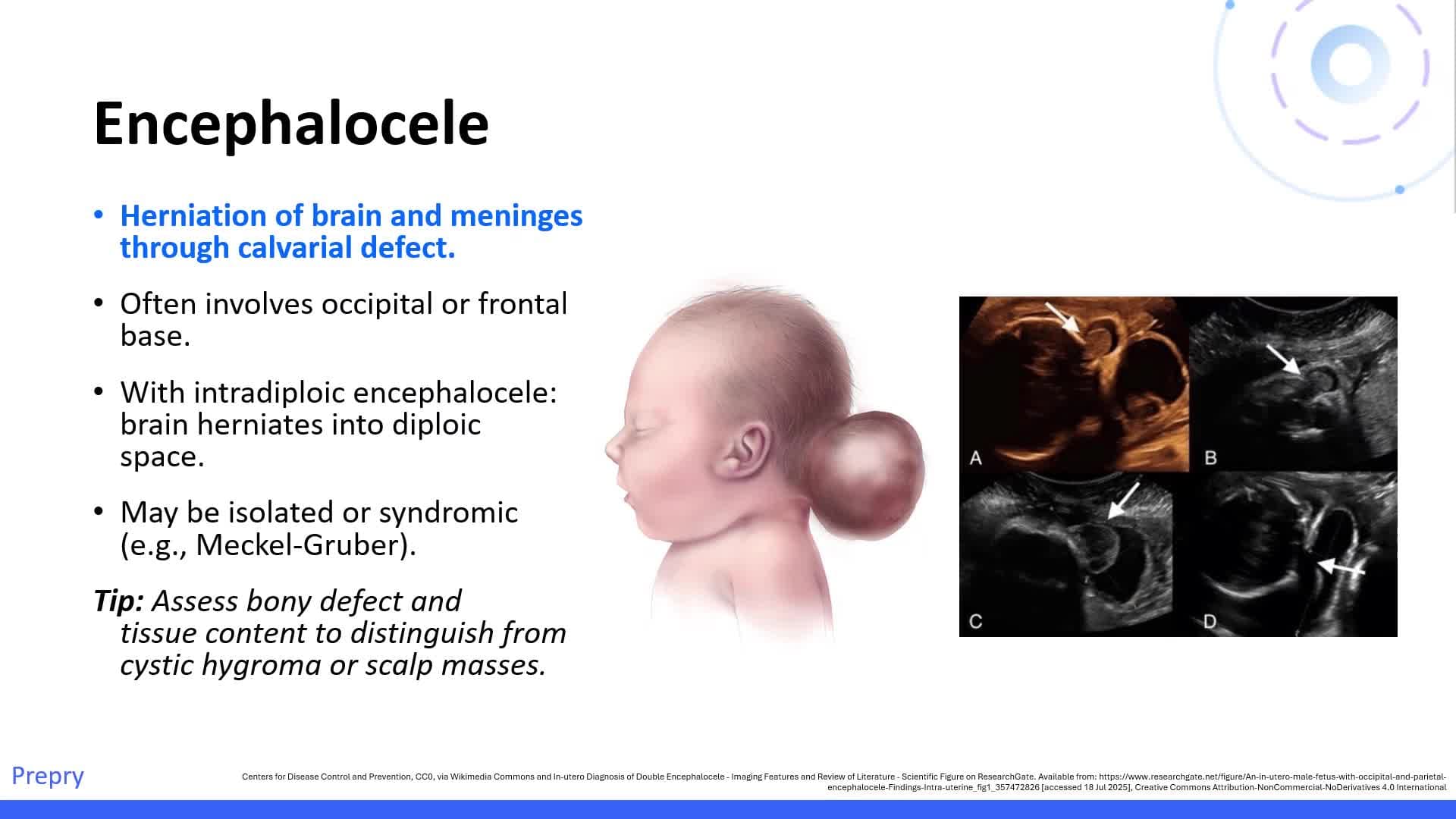 Unit 14 Intracranial-CNS Abnormalities Brain Pt 2
